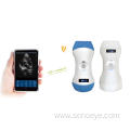 Mini Wireless Ultrasound Scanner